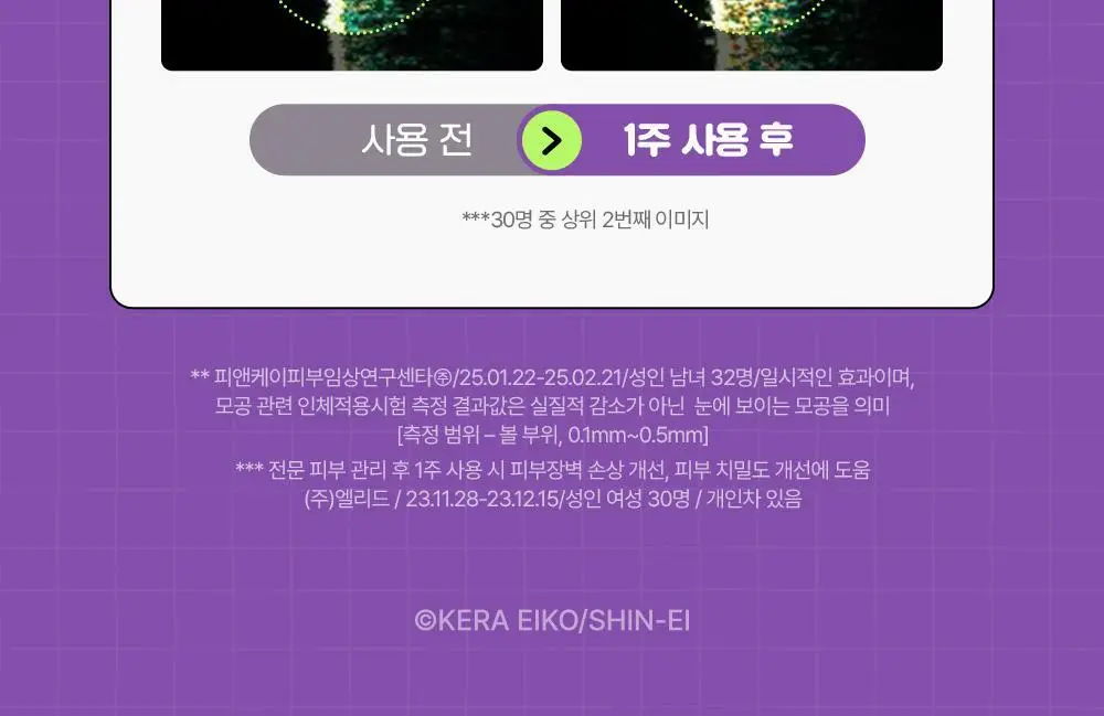 [90ml대용량]차앤박 더마앤서 액티브 부스트 PDRN 앰플 30ml+60ml 리필+대형스티커 (아따맘마 콜라보) 상세페이지 17